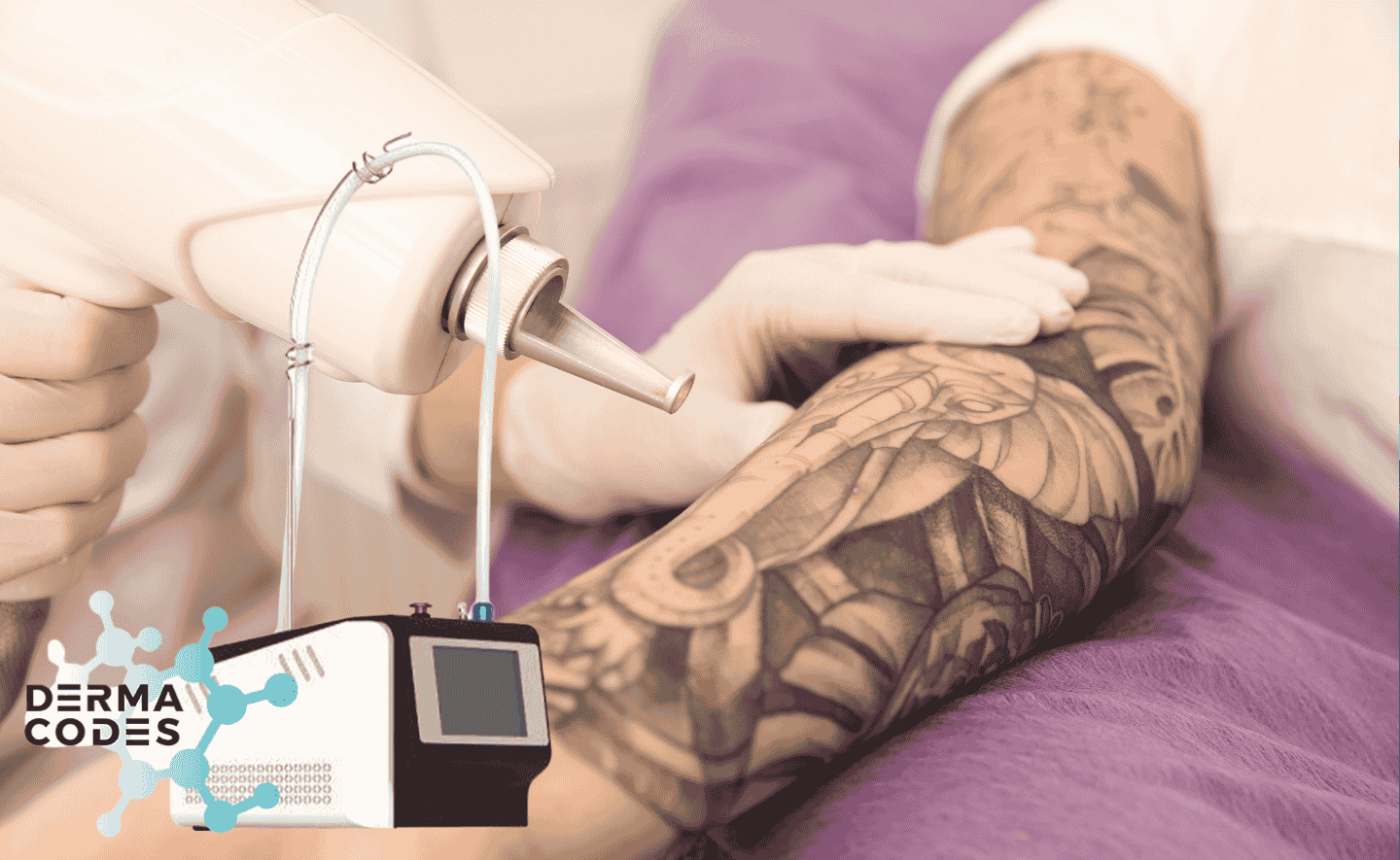 Wat maakt onze Pico Laser zo bijzonder?