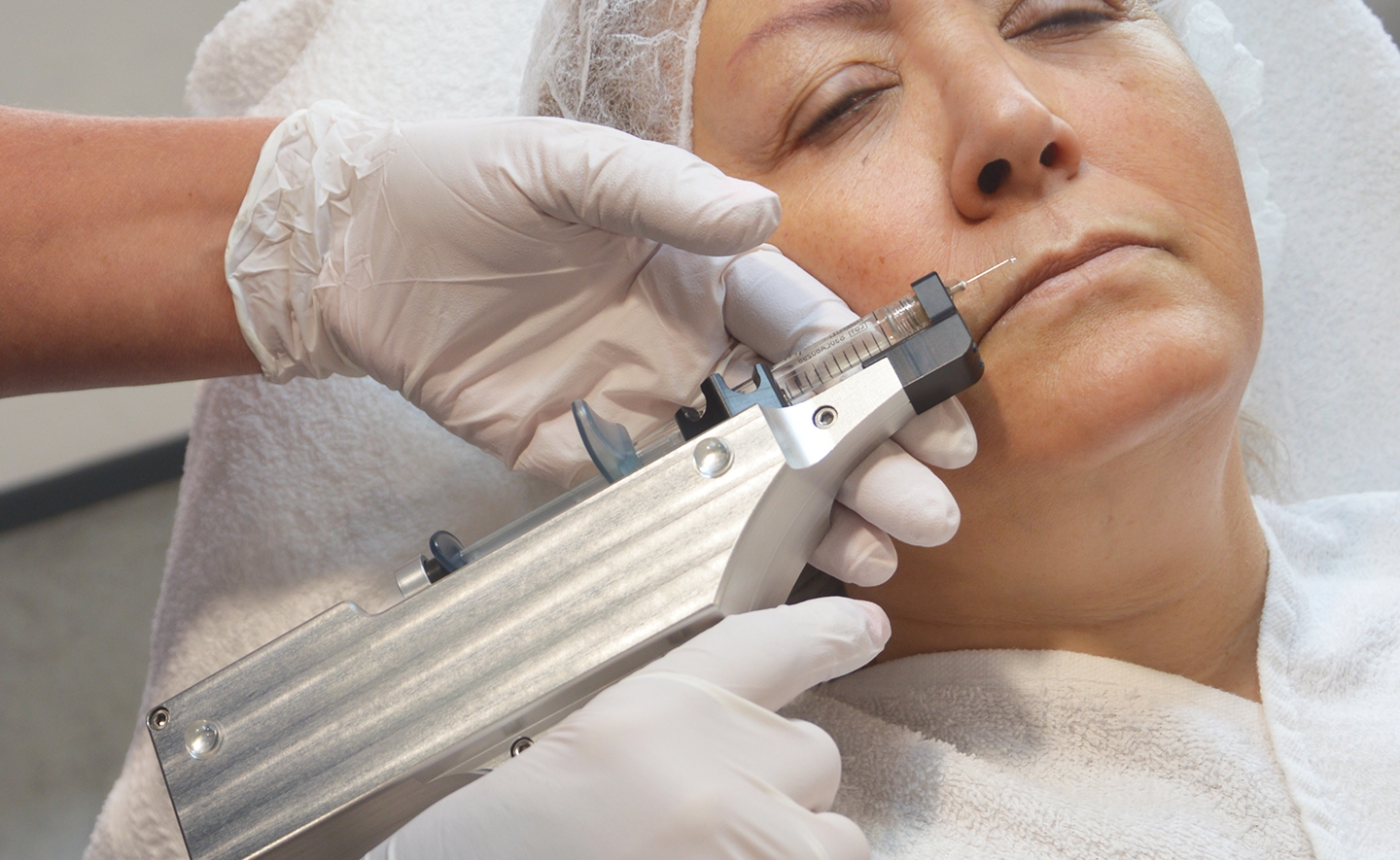 BLOG: Is de Mesogun veilig?