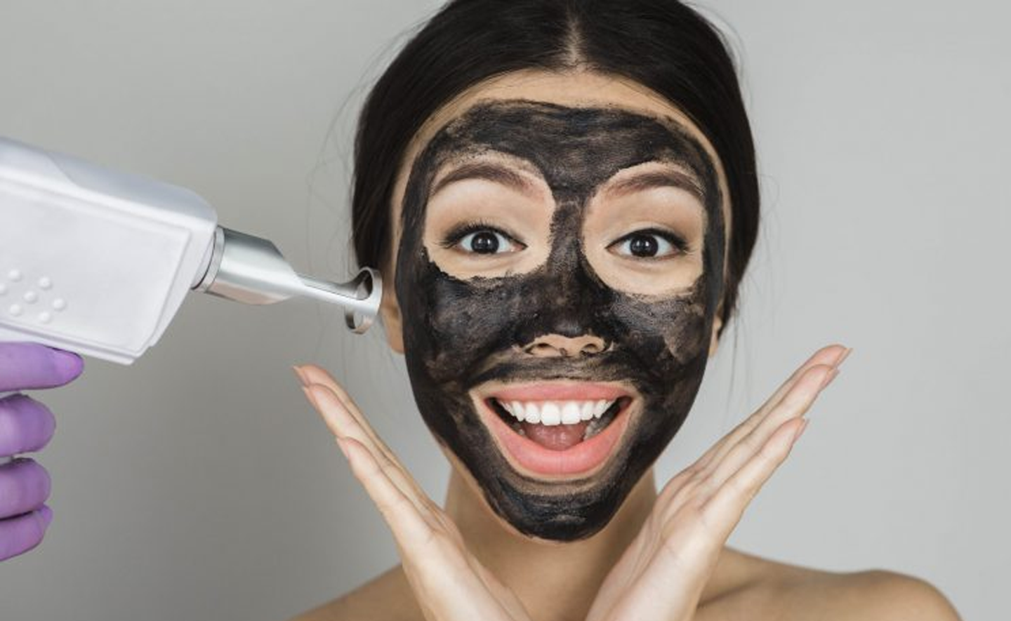 Dé gids voor carbon peeling met een ND-YAG-laser