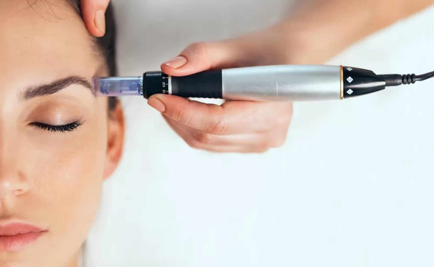 Microneedling met de Dermapen - Hoe werkt het?